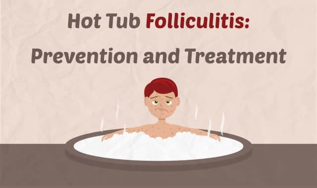 Hot Tub Folliculitis Prevention And Treatment